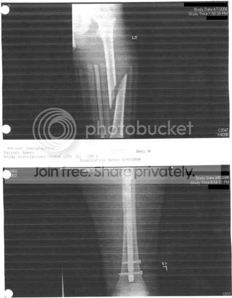 Josh_Leg2.jpg