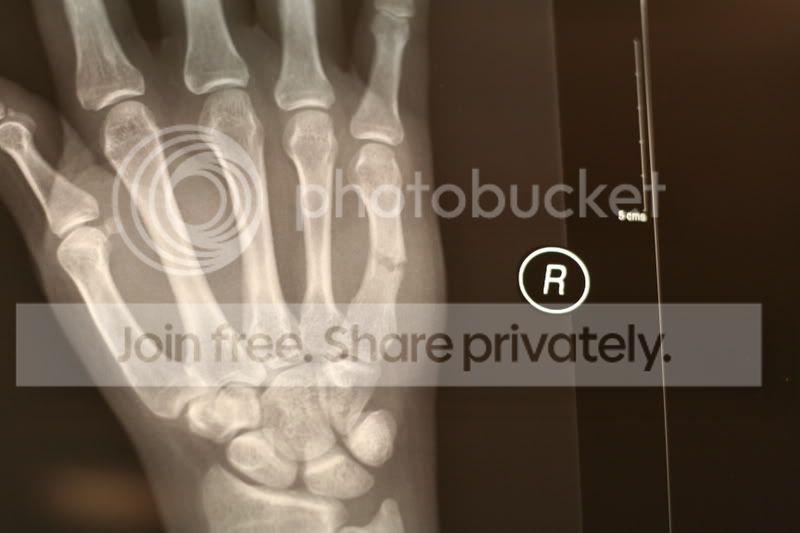 bone1.jpg