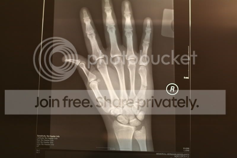 bone2.jpg